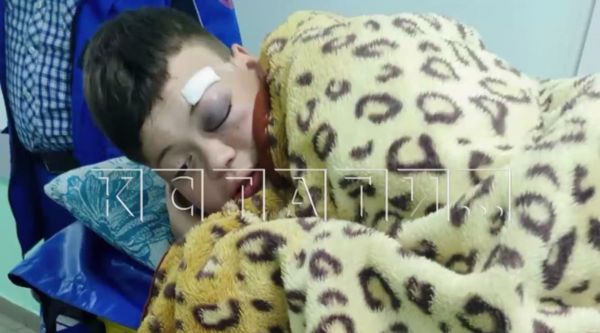 Ученика жестоко избили во время перемены в нижегородской школе - фото 1