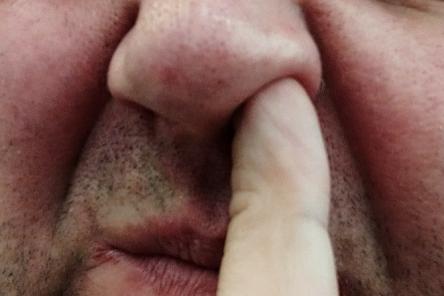 Нижегородский врач рассказал об опасности ковыряния в носу